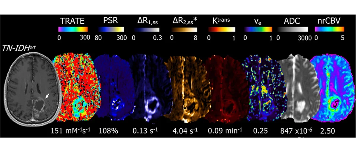 Perfusion imaging of the brain